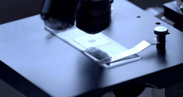 Sample slide observed under microscope