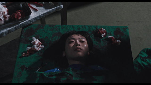 Woman lying on operating table