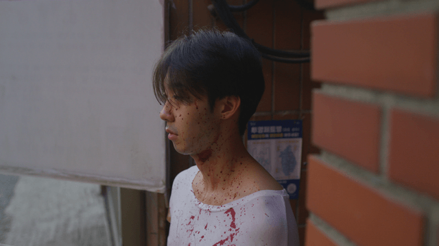 Man with bloodstains on his face and neck