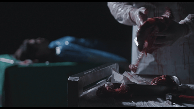 Surgeon touching organ in dark operating room