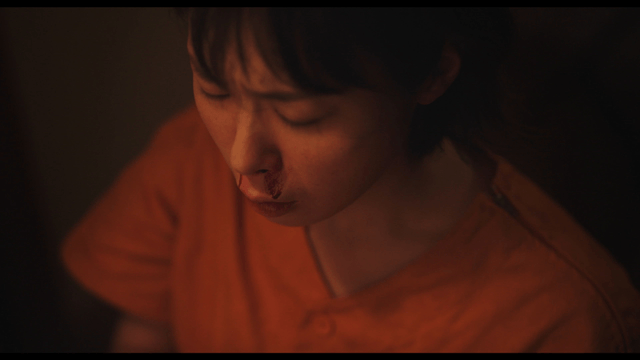 Woman with a nosebleed looking distressed