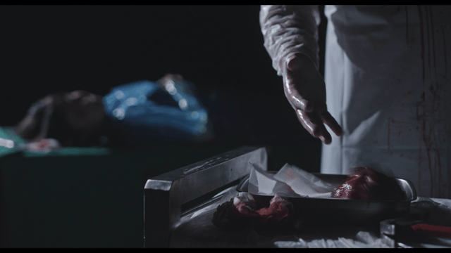 Surgeon placing organ in dark operating room