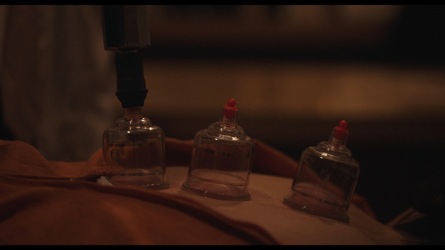 Cupping therapy process in dark room