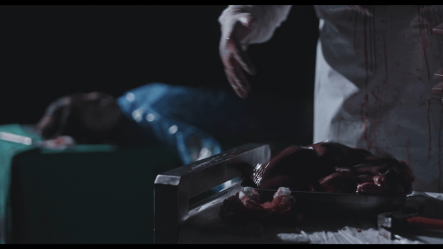 Surgeon placing organ in dark operating room