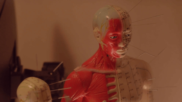 Acupuncture models with needles inserted