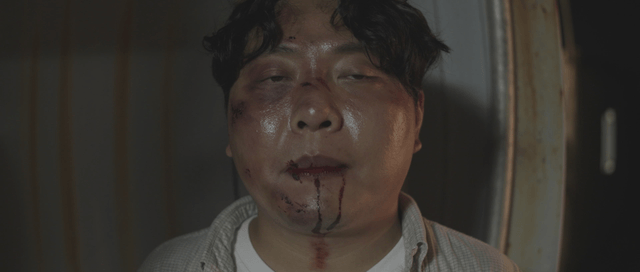 Injured man with bruises and cuts