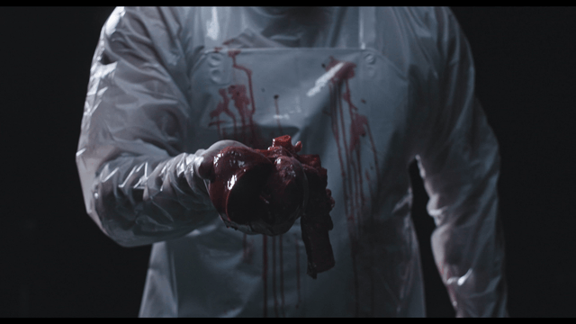 Surgery removing heart